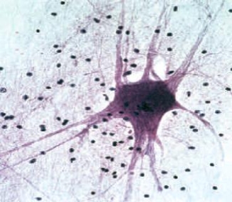 Figure 31.11    -The accompanying figure is a micrograph of what kind of tissue?​ A)  ​cardiac muscle B)  ​skeletal muscle C)  ​nerve tissue D)  ​cartilage E)  ​dense connective 