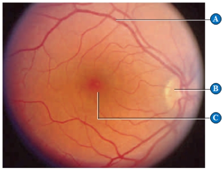 Figure 33.17C    -The letter  C  in the above figure represents the ____. A)  ​cortex B)  ​cornea C)  ​fovea D)  ​blood vessels E)  ​optic nerve 