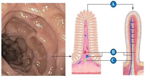    The following question refer to the figure above. -A blood vessel is indicated by the letter ____. A)  ​A B)  ​B C)  C​ D)  ​D E)  E​ 