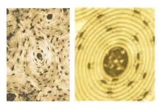 Figure 31.6F    -What kind of tissue is shown in the accompanying images?   A) Blood B) Adipose C) Bone D) Cartilage E) Dense connective