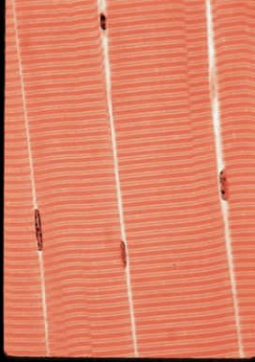 Figure 31.8A    -The accompanying figure is a micrograph of what kind of tissue?   A) Cardiac muscle B) Skeletal muscle C) Smooth muscle D) Cartilage E) Dense connective