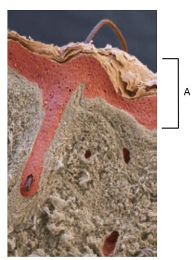 Figure 31.14    -The bracket indicated by the letter  A  in the accompanying figure is ____.   A)  the epidermis B)  a sweat gland C)  the dermis D)  the hypodermis E)  a hair follicle