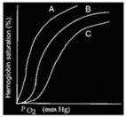  Curve B below represents the oxygen-hemoglobin dissociation curve for normal body temperature,arterial hydrogen ion concentration,and DPG concentration.  \mathrm { P } _ { \mathrm { o } _ { 2 } }  (mm Hg)    A) Curve A may represent the dissociation at higher than normal arterial hydrogen ion concentration B) Curve C may represent the dissociation at lower than normal body temperature C) Curve A may represent the dissociation at very low DPG levels D) Both curve A may represent the dissociation at higher than normal arterial hydrogen ion concentration and curve C may represent the dissociation at lower than normal body temperature are correct E) Both curve A may represent the dissociation at higher than normal arterial hydrogen ion concentration and curve A may represent the dissociation at very low DPG levels are correct 
