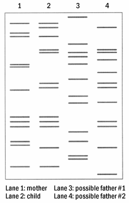 A husband and wife are in the process of getting a divorce.During child-support hearings,the husband states that he should not pay child support as he feels that the child was actually fathered by one of the woman's various lovers.DNA restriction analysis was performed,with the results illustrated in the diagram below.     Figure 18.3 The DNA of the husband in this case can be found in lane 3, whereas that of the suspected father is in lane 4. Based on this information, A) the husband is definitely the child's father. B) the husband is definitely not the child's father. C) either man could be the father, and more tests are needed to discern paternity. D) neither man in question is the child's biological father.