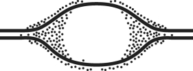 In an experiment, DNA is allowed to replicate in an environment with all necessary enzymes, dATP, dCTP, dGTP, and radioactively labeled dTTP (³H thymidine) for several minutes and then switched to nonradioactive medium. It is then viewed by electron microscopy and autoradiography. The drawing below represents the results.   Grains represent radioactive material within the replicating eye. Figure 16.2 Which is the most likely interpretation? A) There are two replication forks going in opposite directions. B) Thymidine is only being added where the DNA strands are furthest apart. C) Thymidine is only added at the very beginning of replication. D) Replication proceeds in one direction only.