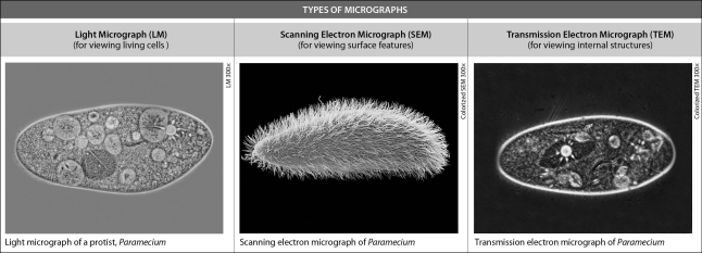 Examine the following photographs.Which of the techniques reveal internal cellular detail?   A)  light micrograph and transmission electron micrograph B)  light micrograph and scanning electron micrograph C)  transmission electron micrograph and scanning electron micrograph D)  all three micrographs