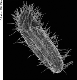 The figure below shows a Paramecium,a single-celled freshwater protist.The hairlike structures visible on the Paramecium allow it to move.These structures are ______.   A)  microfilaments B)  intermediate filaments C)  flagella D)  cilia