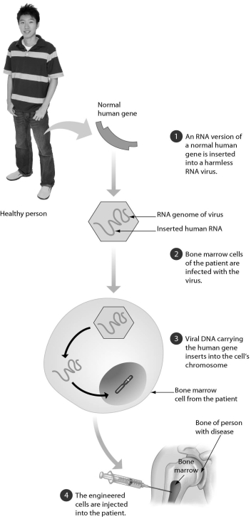 The diagram below summarizes _____.   A)  how a gene is cloned B)  how a human could be cloned C)  human gene therapy D)  how a vaccine is made