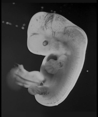 <strong>Examine the embryo in the following figure.The hands and feet of this embryo appear paddle-like,with no distinct toes or fingers.What process is needed to define each of the toes and fingers?  </strong> A) programmed cell death B) neurulation C) gastrulation D) induction <div style=padding-top: 35px> 