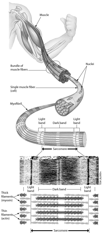 <strong>Examine the structure of a muscle cell in the accompanying figure.Which one of the following statements about muscle structure is true? </strong> A) Each muscle cell has one nucleus. B) Each myofibril consists of many muscle cells. C) Each muscle cell has two to three sarcomeres. D) A sarcomere contains thick and thin filaments.