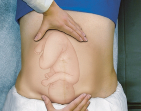 The healthcare provider is using Leopold's maneuvers to assess fetal positioning.Which of the following maneuvers is being used in the figure below?   A) First Leopold's maneuver B) Second Leopold's maneuver C) Third Leopold's maneuver D) Fourth Leopold's maneuver 