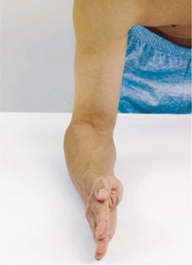 The nurse is caring for a client with an injury to the arm.To check the client ability to move the nurse directs the client to pronate the hand.Indicate the side of the table that arm should be rotated towards.  