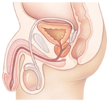 The nurse is providing education to a client who has been experiencing symptoms consistent with BPH.The nurse presents a diagram the client to illustrate the location of the prostate.Mark with an  X  the correct location of the prostate gland.  