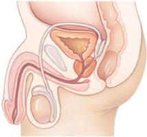 The nurse is caring for a client who has hypospadias .Mark the figure provided to illustrate the location of the phenomena.  