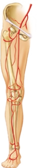 The client developed a pulmonary embolism.Draw an arrow pointing toward the most distal area of the lower extremity from where the embolism most likely originated.  