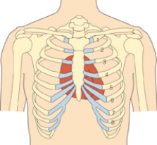The nurse is performing a cardiac assessment and prepares to palpate the client's heartbeat on the client's chest.Draw an arrow pointing to this area.  