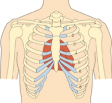 The nurse is reviewing the client's chart.The client's blood pressure has been consistently elevated over the last eight years.The client has been noncompliant with lifestyle changes and medication use designed to reduce the client's blood pressure.Today,the nurse is able to palpate a heave on the client's chest.Draw an arrow to the most likely location that the nurse is able to palpate the heave.  