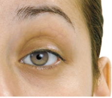 The nurse is assessing the client's corneal reflex.Draw an arrow pointing to the area of the eye that the nurse should test for the presence of this reflex.  