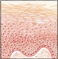 The nurse has performed a focused interview with the client and is preparing to perform a skin assessment while the student nurse observes.The student nurse asks, Where exactly is the stratum basale located?  Identify the stratum basale in the following figure by placing an arrow pointing toward this area.[Please insert figure 11-1 from D'Amico 2nd edition: Skin structure,3-dimensional view of skin….Remove all labels]  