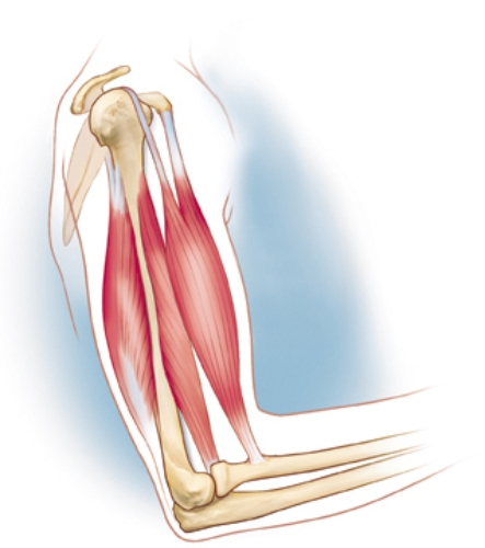The nursing instructor is evaluating the knowledge of the student in locating the landmarks for assessing tricep skinfold measurements.Mark with and label the correct landmark for this technique.  