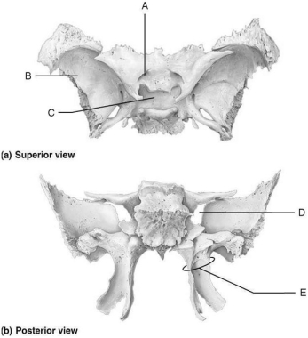   Figure 7.2 Using Figure 7.2, match the following: -Allow cranial nerves that control eye movements to enter the orbit. A) B B) E C) D D) A E) C