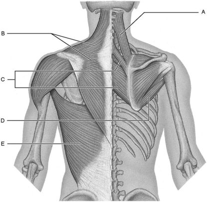   Figure 10.3 Using Figure 10.3, match the following: -Levator scapulae. A) D B) A C) B D) E E) C