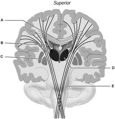   Figure 12.2 Using Figure 12.2, match the following: -Caudate nucleus. A) A B) B C) C D) D E) E