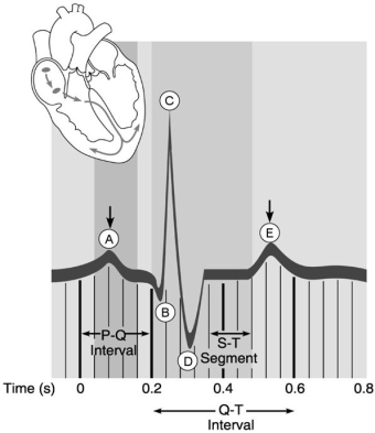   Figure 18.2 Using Figure 18.2, match the following: -Point after which pressure begins to rise in the aorta. A) A B) D C) E