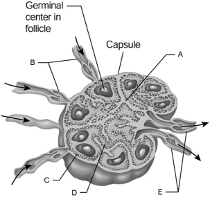   Figure 20.2 Using Figure 20.2, match the following: -Trabecula. A) D B) C C) E D) A