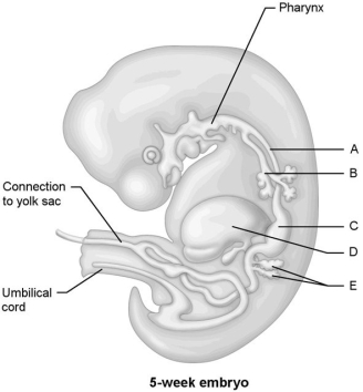     Figure 28.1 Using Figure 28.1, match the following: -Pancreas. A) A B) B C) D D) E E) C