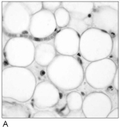           Figure 4.1Using Figure 4.1, match the following: -Composed of cells in a fluid matrix.