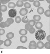           Figure 4.1Using Figure 4.1, match the following: -Composed of cells in a fluid matrix.