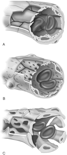   Figure 19.1Using Figure 19.1, match the following: -The mesenteric arteries branch off the abdominal aorta, but the mesenteric veins do not connect directly to the vena cava. Why?