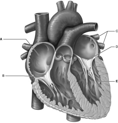   Figure 18.4Using Figure 18.4, match the following: -Right atrium.