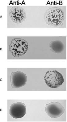   Figure 17.2Using Figure 17.2, match the following: -Type B.