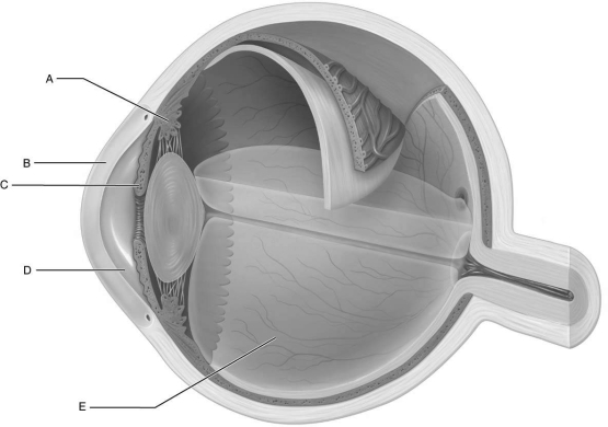   Figure 15.3Using Figure 15.3, match the following: -Holds the retina firmly against the pigmented layer.