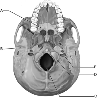   Figure 7.3 Use the diagram above to answer the following questions. -Which letter indicates the palatine bone that forms part of the hard palate? A)  A B)  B C)  C D)  D E)  E