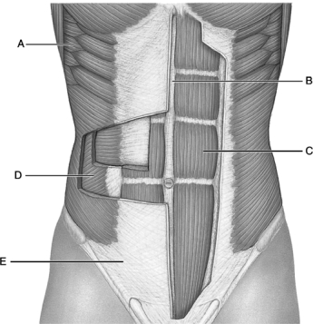  Figure 11.1 Use the diagram above to answer the following questions. -Identify the letter that indicates the Rectus abdominis. A)  A B)  B C)  C D)  D E)  E