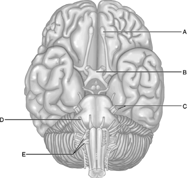   Figure 14.2 Use the diagram above to answer the following questions. -Which cranial nerve pair, similar to cranial nerve II, runs through a canal that bears the same name? A)  IV B)  V C)  VIII D)  XI E)  XII