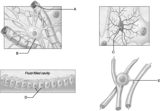 <strong> Figure 12.2 Use the diagrams above to answer the following questions. Identify which diagram represents a microglial cell.</strong> A) A B) B C) C D) D E) E