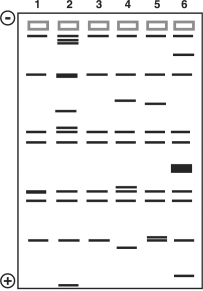 Figure 10.3 This figure shows the results of a gel electrophoresis separation of restriction fragments of the DNA of different organisms.    -In Figure 10.3, which two are most closely related? A)  3 and 5 B)  4 and 5 C)  1 and 3 D)  2 and 4 E)  2 and 5