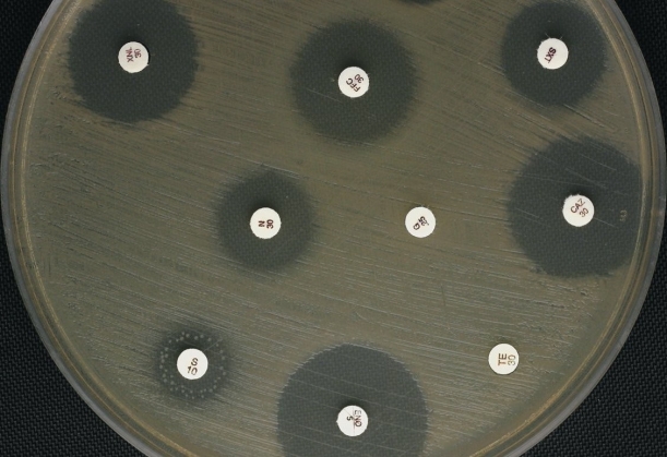    Examine the diffusion susceptibility plate results shown in Figure 10.2.Propose an explanation for the appearance of the zone around the S/10 disk,and discuss the implications for therapeutic use of this antibiotic for the pathogen tested.
