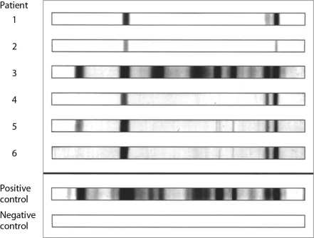   The assay shown in Figure is used for what? A)  detecting antibodies against a complex mix of antigens B)  verifying infection with a virus C)  determining the concentration of antibodies D)  detecting neutralizing antibodies E)  blood typing