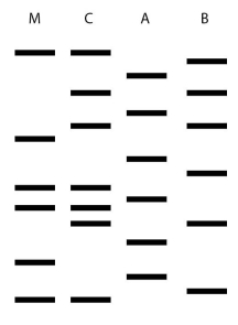 <strong> Two men may be the father of a child.Figure 8.2 shows the results of a DNA fingerprint analysis to determine paternity.M is the mother,C is the child,A and B are the two men.What is the best interpretation of these results?</strong> A) The man identified as A is probably the father. B) The man identified as B is probably the father. C) Neither man is this child's father. D) Either man could be this child's father. E) Paternity cannot be determined from this data.