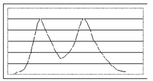 State whether the distribution appears to be (roughly) normal. -  A) Not normal B) Normal