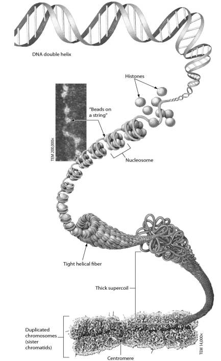 <strong>Examine the figure below.Nucleosomes are made of ________.  </strong> A) RNA and protein B) DNA C) proteins D) DNA and histone proteins <div style=padding-top: 35px> 