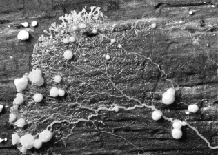 What kind of protist is this?   A)  ciliate B)  plasmodial slime mold C)  flagellate D)  foram