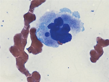   -Identify the cell at the tip of the pointer (bone marrow smear) . A)  Myeloblast B)  Megakaryocyte C)  Nucleated red cell D)  Reed Sternberg cell