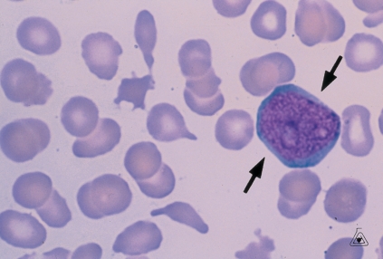   -Identify the cell at the end of the pointer. A)  Lymphocyte B)  Myeloblast C)  Promyelocyte D)  Monocyte