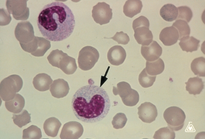   -Identify the cell at the end of the pointer. A)  Band neutrophil B)  Metamyelocyte C)  Promyelocyte D)  Monocyte